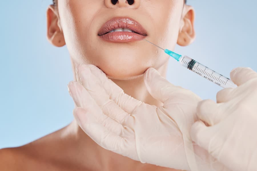 Médico aplica botox na boca de mulher