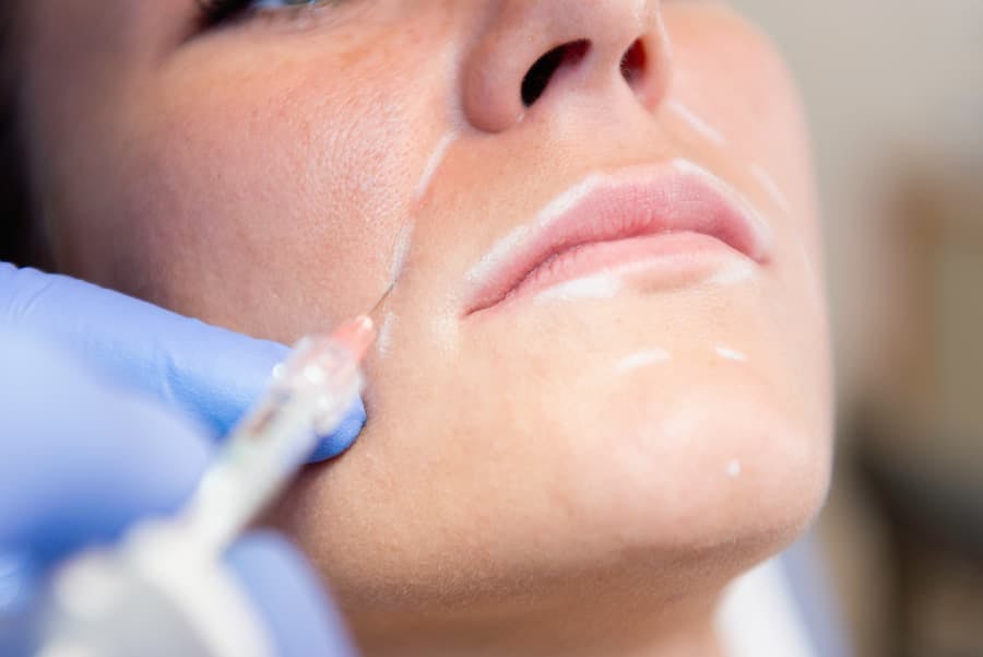 médico aplica injeção no rosto de mulher